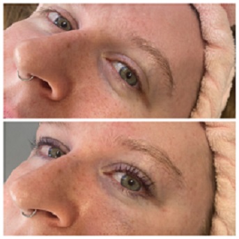 Brow and lash treatment